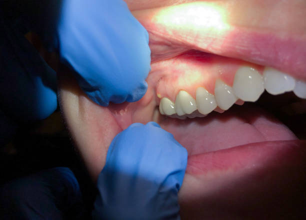 Best Tooth Infection Emergency Dentist  in Silver Grove, KY
