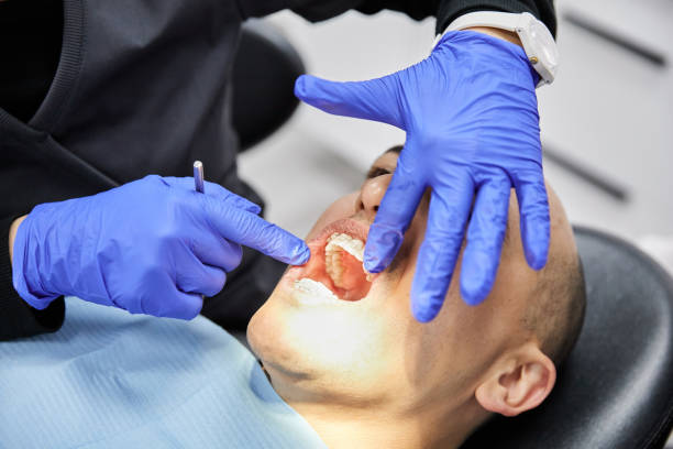 Best Chipped Tooth Repair Near Me  in Silver Grove, KY
